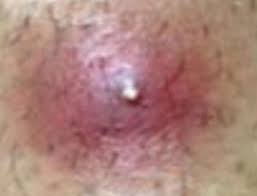 Find out what your armpit lump may be, and how to treat it. Pin On Health Issues And Solutions Motivational Doc