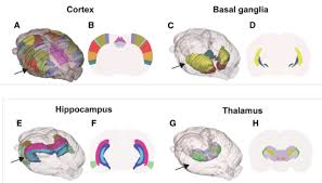 The anatomical structures are all translated from the terminologia anatomica into english, french, spanish, portuguese, chinese, italian, polish, german. 3d Reconstruction Of Mouse Brain Anatomy Showing True Location Download Scientific Diagram