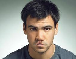 Dr Sergio Ruben Candelas Rubalcava Cirujano Maxilofacial en Irapuato