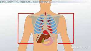 What organs are located under your rib cage? Chest Contusion Complications Treatment Recovery Time Video Lesson Transcript Study Com