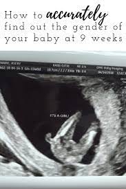 How To Accurately Find Out The Gender Of Your Baby At 9 Weeks - Aseky + Co.