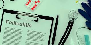 التهاب الجريبات folliculitis صحتنا