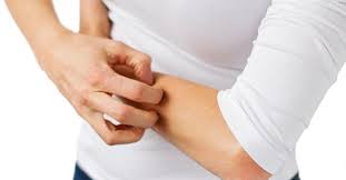 Kasinti Neden Olur Deri Kasintisinin Nedenleri Nelerdir Saglik Haberleri