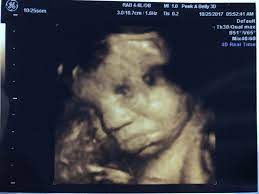 34 Week 3d 4d Ultrasound 6 More Weeks And She Is Gorgeous She Is Gorgeous 4d Ultrasound Ultrasound