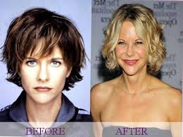 Meg ryan plastic surgery before after. Celebrity Meg Ryan Plastic Surgery Photos Video