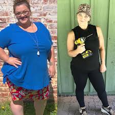 What if i see blood in the stool after gastric bypass surgery? The Most Inspiring Gastric Bypass Before And After Photos