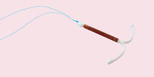 how do you check your iud strings