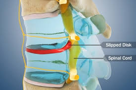 For example, some muscles located in the chest also help move the shoulders. Common Spine Problems Explained With Pictures