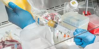 Image result for Apheresis