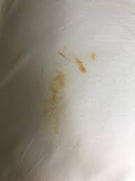 Check spelling or type a new query. What Are These Strange Rust Like Stains All Over Bedding Nothing Gets Them Out Not Even Bleach They Come In Various Shades Of Yellow To Deep Orange And I Can T Figure It