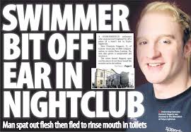 SWIMMER BIT OFF EAR IN NIGHTCLUB