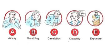 Besonderheiten bei der notfallversorgung von geriatrischen traumapatienten @inproceedings{barzen2019besonderheitenbd, title={besonderheiten bei der notfallversorgung von geriatrischen traumapatienten}, author={s. Samariterforum Ch A Twitter Vor Ca 2 Wochen Erhielt Ich Die Anfrage Wie Ich Das Abcde Schema Einfach Zu Papier Bringen Wurde Der Wunsch Wurde Geaussert Das Es So Aussehen Konnte Wie Das Fast Schema Darum