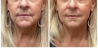 Courtyard Aesthetics