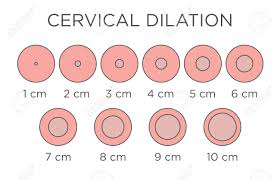 Cervical Dilation Medical Illustration Chart In Centimeters