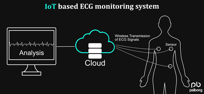 IoT Heart Attack Detection & ECG Monitoring