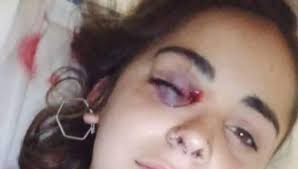 El registro de femicidios arrojó que en el 38,6% de los femicidios fueron en la vivienda de la exigimos justicia por úrsula, asesinada por su ex novio (policía bonaerense) en rojas, provincia de. Arayqmf2lqaeym