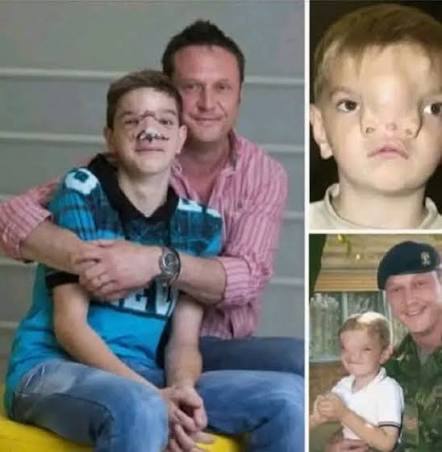 British soldier helps boy with rare facial condition