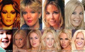 Buenas noches, se limitó a escribir adriana, junto al pie de la foto hot tan comentada. El Antes Y Despues De Las Mas Lindas Infoveloz Com
