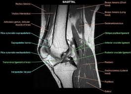Sep 22, 2020 · diagram of costovertebral joints anatomy (a. Knee Imaging Knee Sports Orthobullets Sagittal Mri Knee Mri Cruciate Ligament Ligament Injury