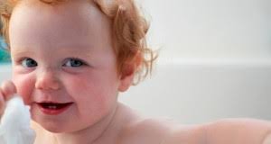 More meanings for croûtes de lait. Les Croutes De Lait De Bebe Comment S En Debarasser