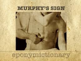 Murphy S Sign Litfl Medical Eponym Library