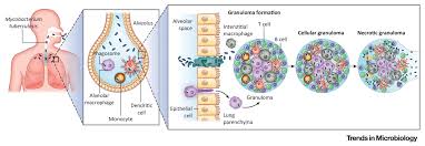 The bacteria usually attack the lungs, but they can also damage other parts of the body. Mycobacterium Tuberculosis Trends In Microbiology
