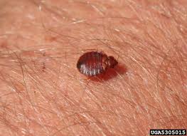 Bed bugs are those pests that burn a hole through your pocket. Bedbugs Arthropod Reaction Dermatology Advisor
