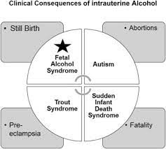 Biomarkers In Fetal Alcohol Syndrome Sciencedirect