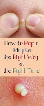 How To Pop A Pimple The Right Way At The Right Time Pimple Popping Pimples Skin Care Treatments