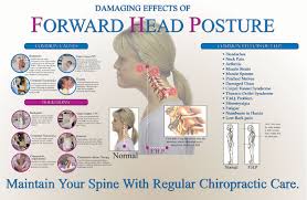 Neck pain can cause headaches, and your doctor may call them cervicogenic headaches. Causes And Correction Of Fhp Shelby Family Chiropractic