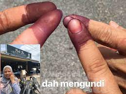 Cara menghilangkan ketombe secara alami demi rambut yang indah dan bebas ketombe. Lima Tahun Lagi Ikut Cara Ini Kalau Hendak Mengundi Dengan Mudah Dan Cepat Mingguan Wanita