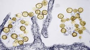 Hantaviruses are a large group of viruses that circulate asymptomatically in rodents, insectivores and bats, but sometimes cause illnesses in humans. Hantavirus Breitet Sich Aus 2019 Ist Ganz Deutlich Ein Ausbruchsjahr Stern De