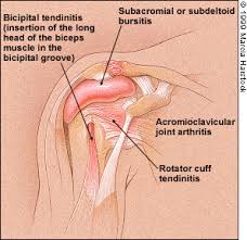 What are the different shoulder muscles? Adhesive Capsulitis A Sticky Issue American Family Physician