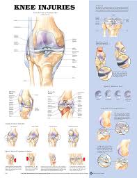 knee injuries anatomical chart