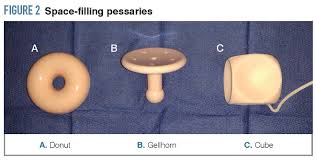 Image result for Pessary