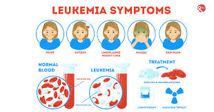 Image result for Leukemia