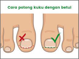 Toe, toes, thumb, thumbs, big toe, opposable, left thumb, right thumb. Cara Merawat Kaki Cagu Kuku Cekam Ibu Jari Kaki Bengkak Dan Sakit