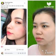 DOPING LIỀU CAO CHO TUẦN MỚI TRÀN ĐẦY NĂNG LƯỢNG