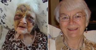 Grandmother left with serious facial injuries in care home incident before  she died