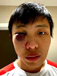 UK Teen Sentenced to 18 Months 'Youth Rehab' for Racist 'Coronavirus'  Attack