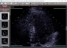 Dicom viewer free for windows. Download Portable Radiant Dicom Viewer 4 6 8
