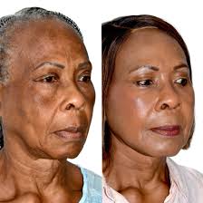 Andres Bustillo, MD, FACS