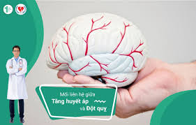 Người bị đột quỵ để lại nhiều di chứng nặng nề như bị liệt nửa thân, mất khả năng kiểm soát tiểu những người có nguy cơ bị đột quỵ cao là người cao tuổi. Má»'i Lien Há»‡ Giá»¯a TÄƒng Huyáº¿t Ap Va Ä'á»™t Quá»µ Ngay Ä'áº§u Tien