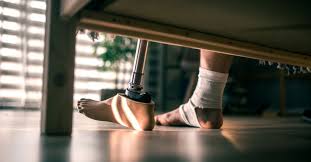 What Is a Catastrophic Injury? Long-Term Impact & Legal Options