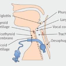 Pdf Tracheostomy Management