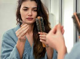 The Skin Nerd: 10 things you should know about hair loss