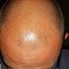Dark Vellus Hair
