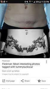 Pin On Tummy Tuck