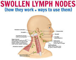 Lymphatic System Lymphatic Drainage Massage Lymph Nodes Swollen Lymph Nodes