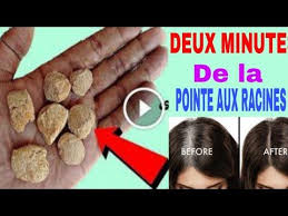 Vos Cheveux Redeviendront Noir De La Pointe Aux Racines Quelque Soit Votre Type De Cheveux Youtube Perte De Cheveux Soin Cheveux Type De Cheveu